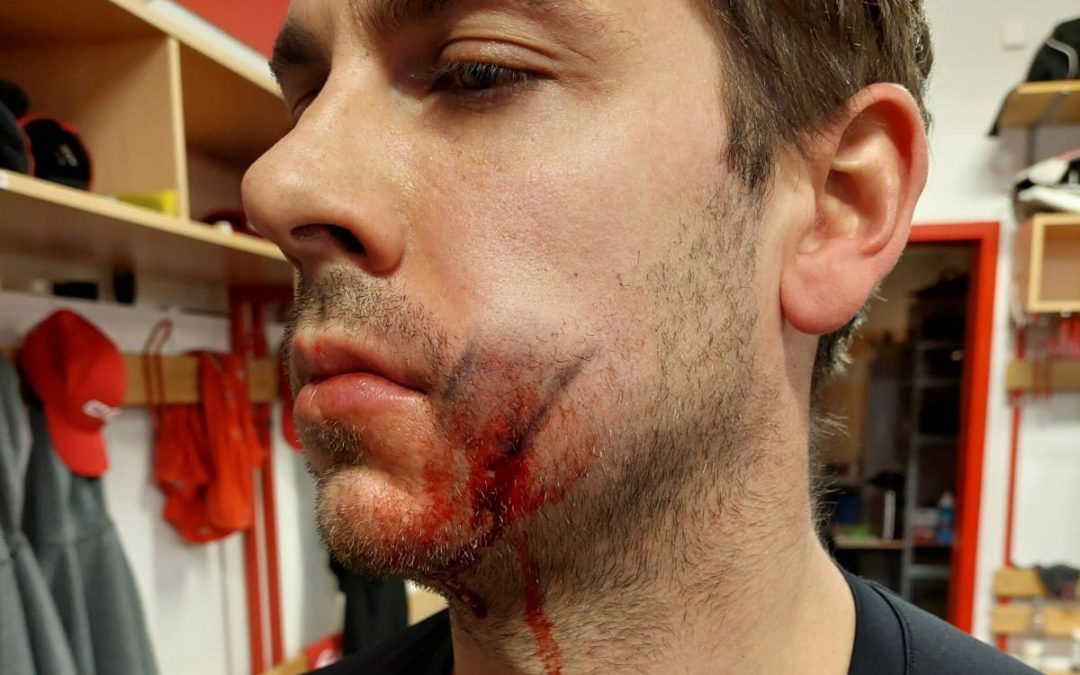 Entwarnung bei Tyler Gron nach Trainingsunfall